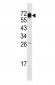 CD105/Endoglin Antibody (Center E395)